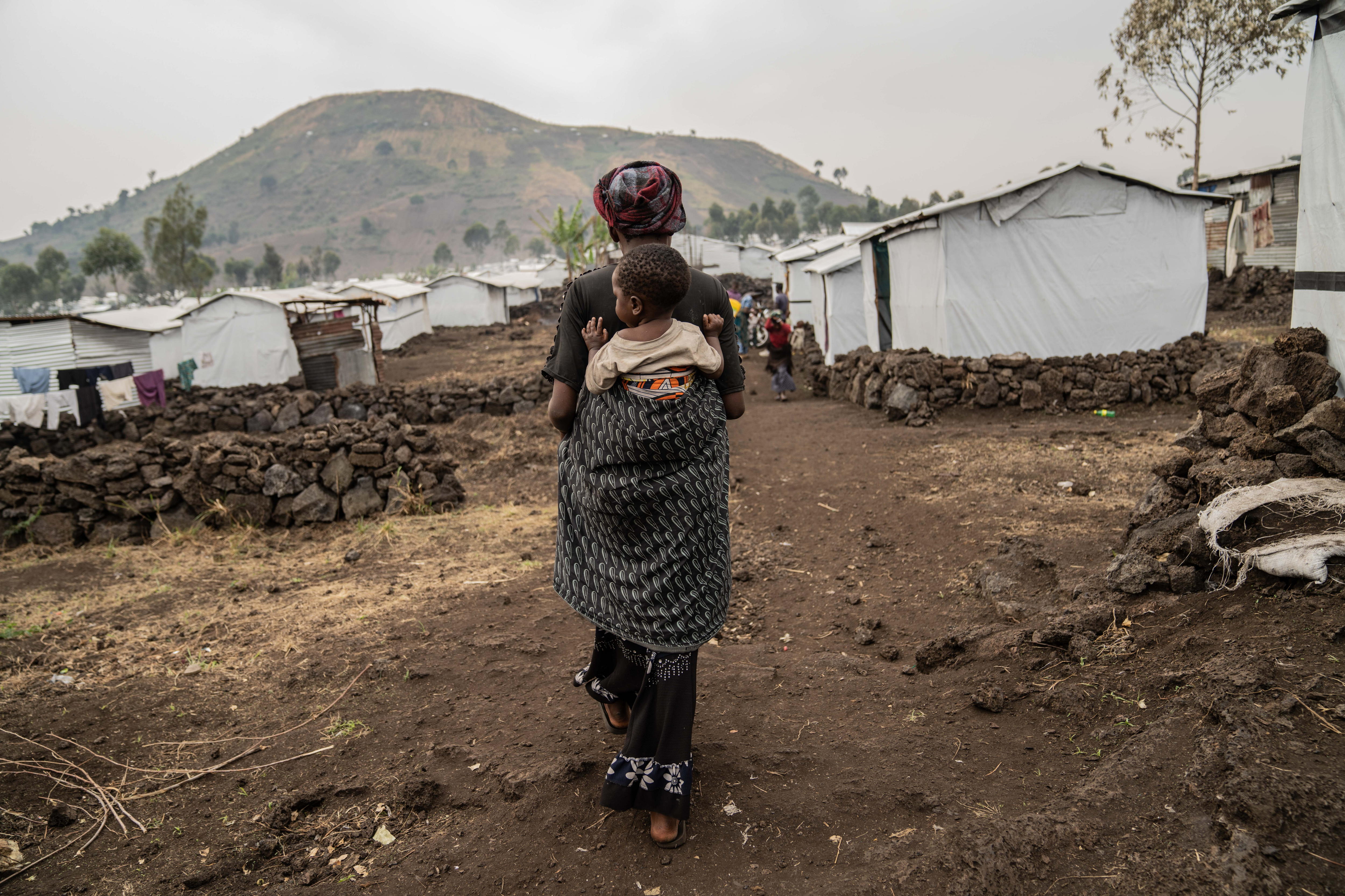 Mpox: OIM pide ayuda para atender a migrantes en riesgo de contraer la enfermedad