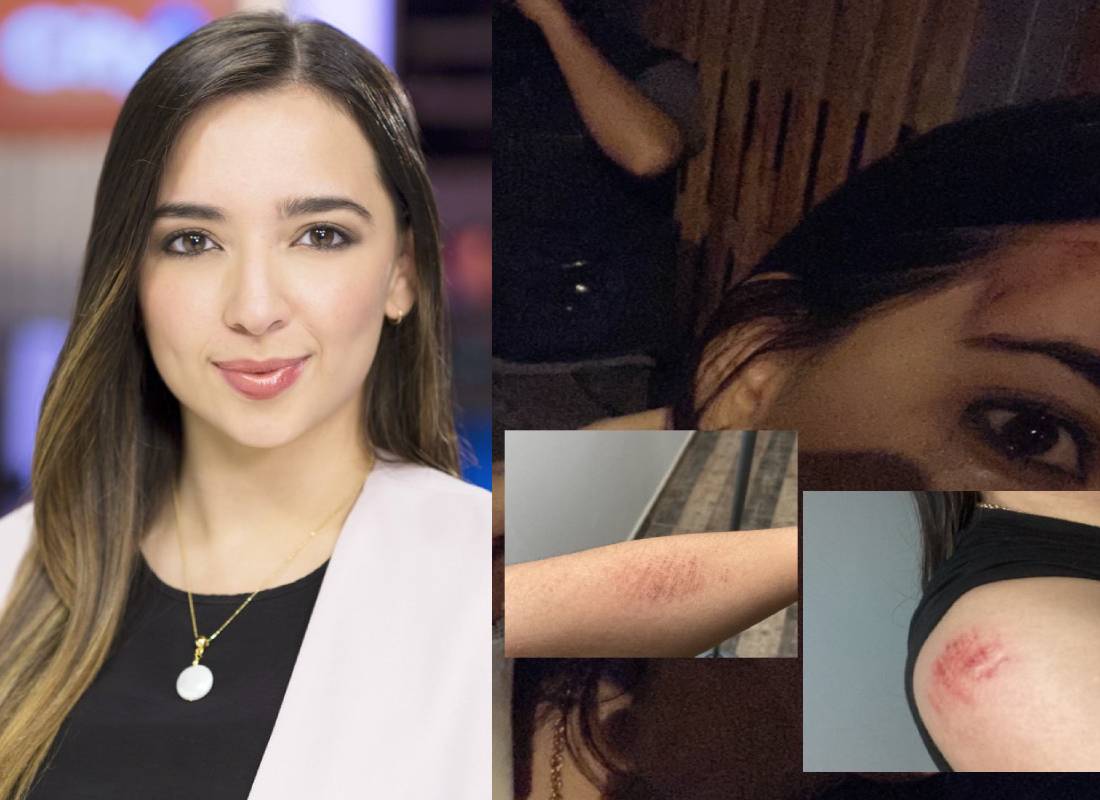 Periodista sufrió golpiza en un taxi que tomó en el norte de Bogotá