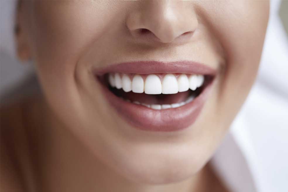 ¿Cómo blanquear tus dientes en casa de manera natural y sin dañar el esmalte?