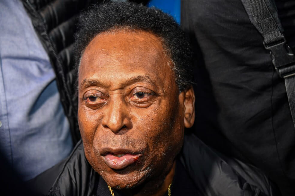 Pelé será sometido a remoción de cálculo en vías urinarias