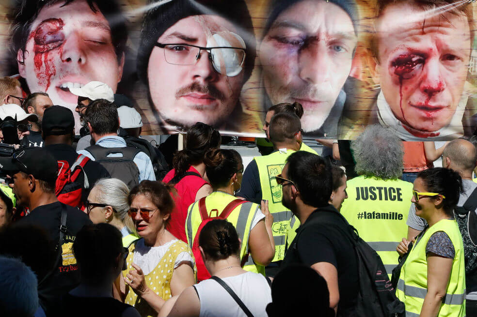 En fotos: Las manifestaciones en París de los “chalecos amarillos mutilados”