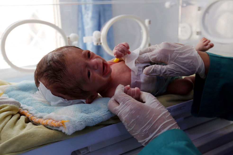 En imágenes: La lucha de los niños en Yemen por sobrevivir