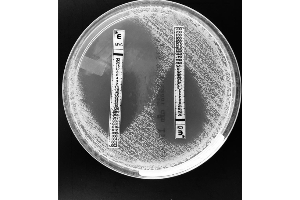 Otra señal para pararle bolas al hongo Candida auris
