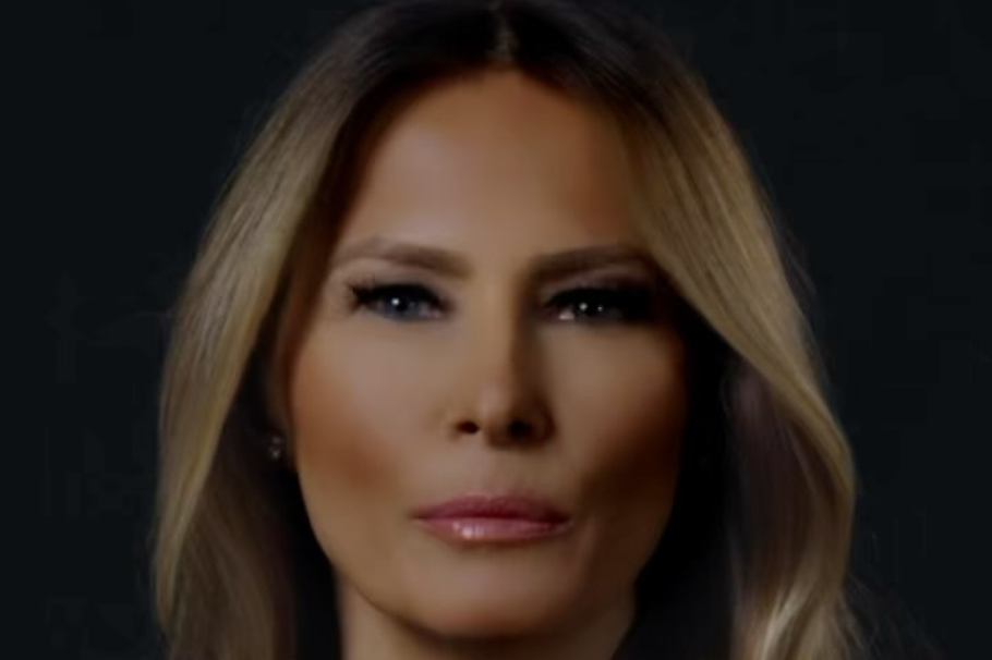 Experto revela cuáles son los retoques estéticos de Melania Trump