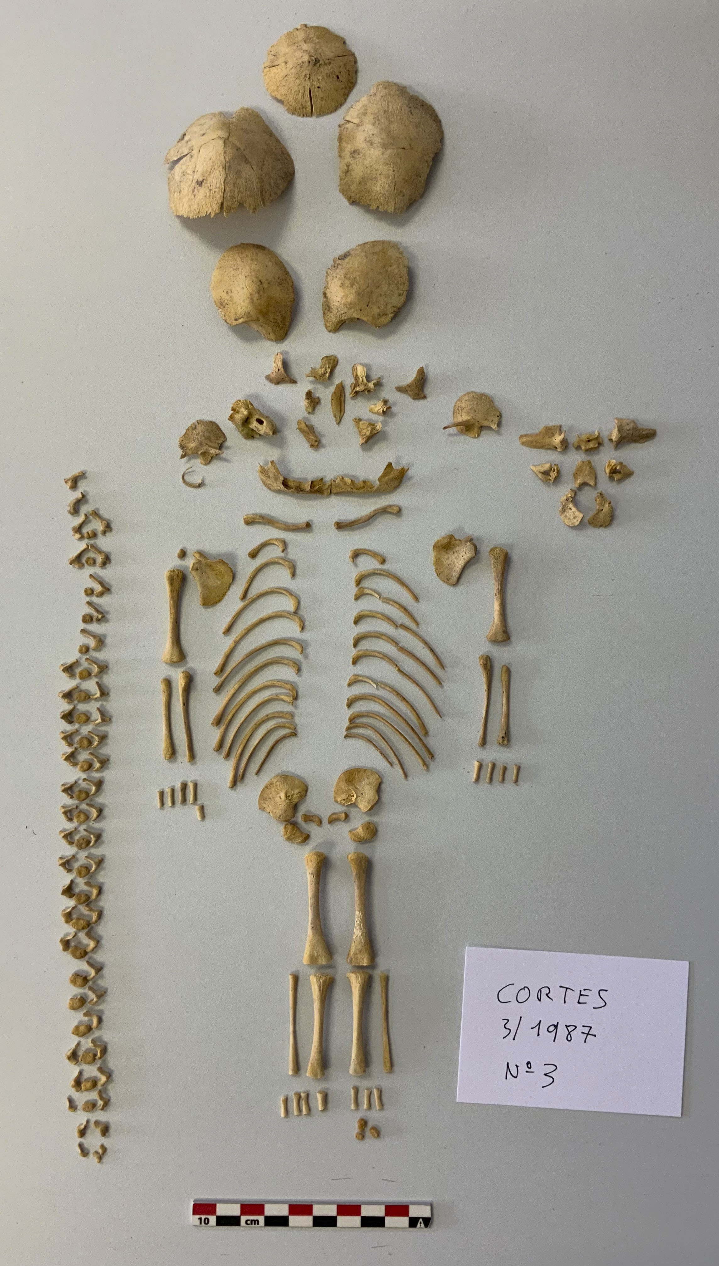 Identifican síndrome de Down en bebés de hace 2.600 años a través de su ADN