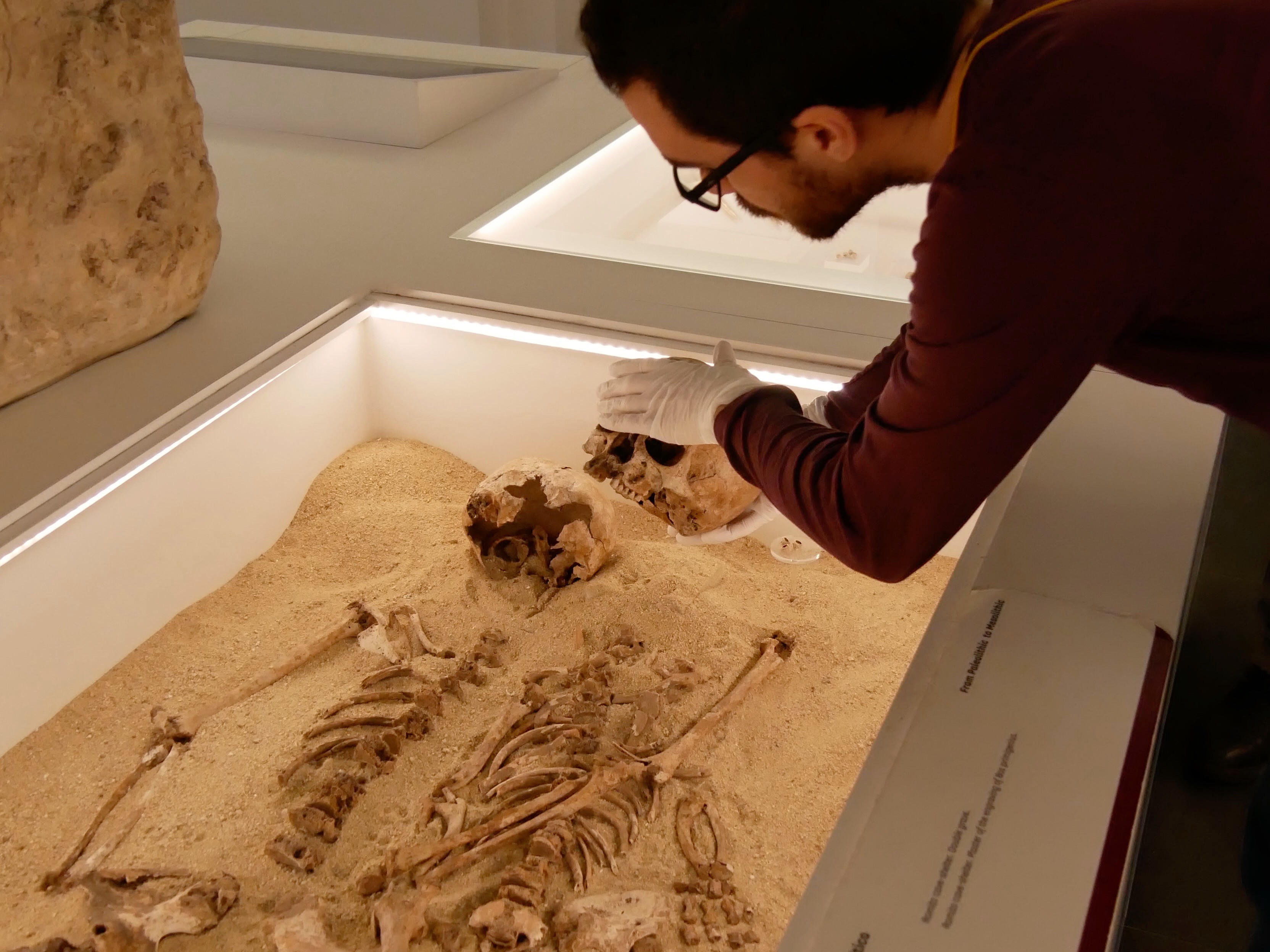 Científicos descubren el caso de una enfermedad rara en individuos de hace 12.000 años