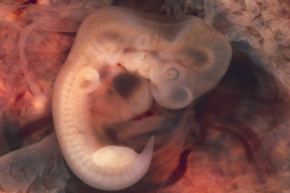 Españoles afirman haber creado el primer embrión de mono con células humanas
