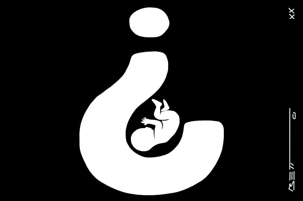 Aborto