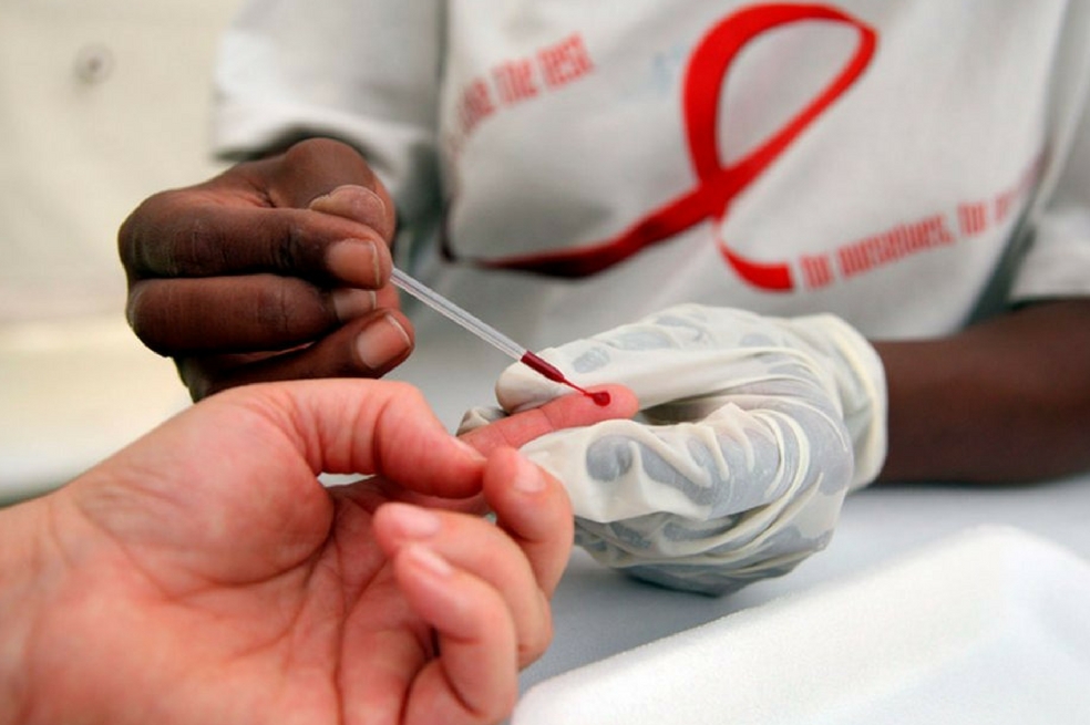 Identificar esta proteína en la sangre facilitaría la detección de VIH en el mundo