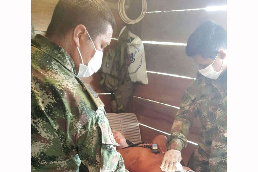 Mina antipersonal causó graves heridas a un menor en Putumayo