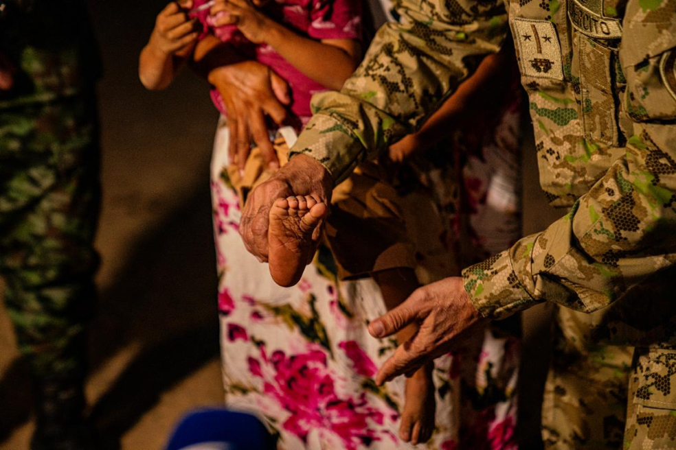 Tras brigada médica del Ejército, niño wayuu con condición genética pudo caminar