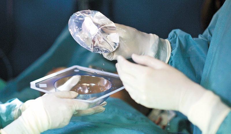 FDA recibe reportes que relacionan a los implantes mamarios con otros tipos de cáncer