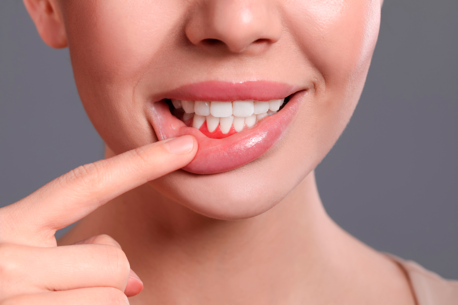 No más sensibilidad dental: odontólogo explica cómo prevenirla con hábitos diarios