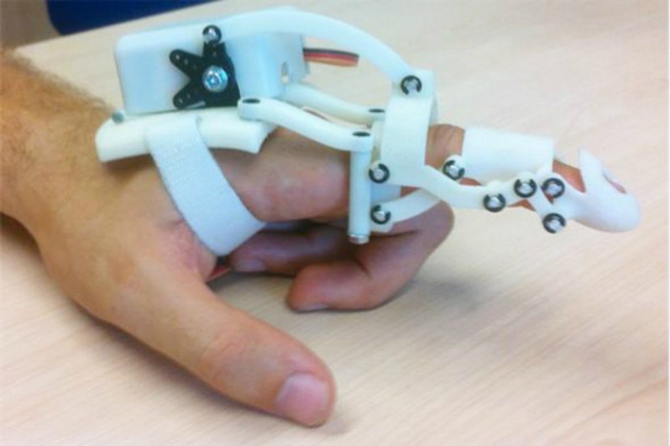 Así es el prototipo de prótesis que se puede hacer a partir de una impresora 3D. / Fundación Descubre - Agencia Sinc