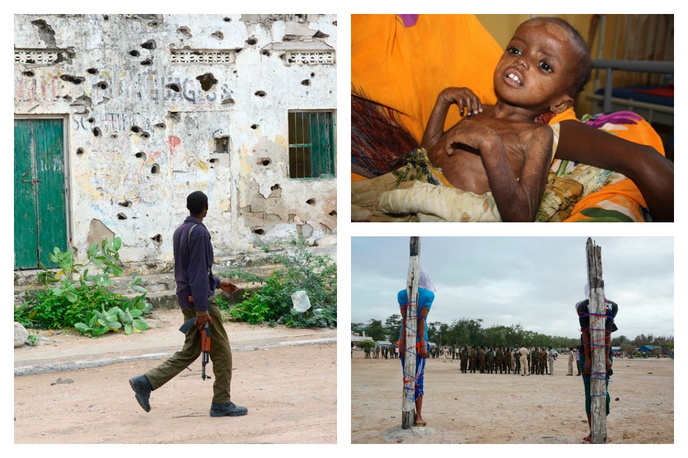 Impactantes imágenes de desnutrición y crisis social en Somalia