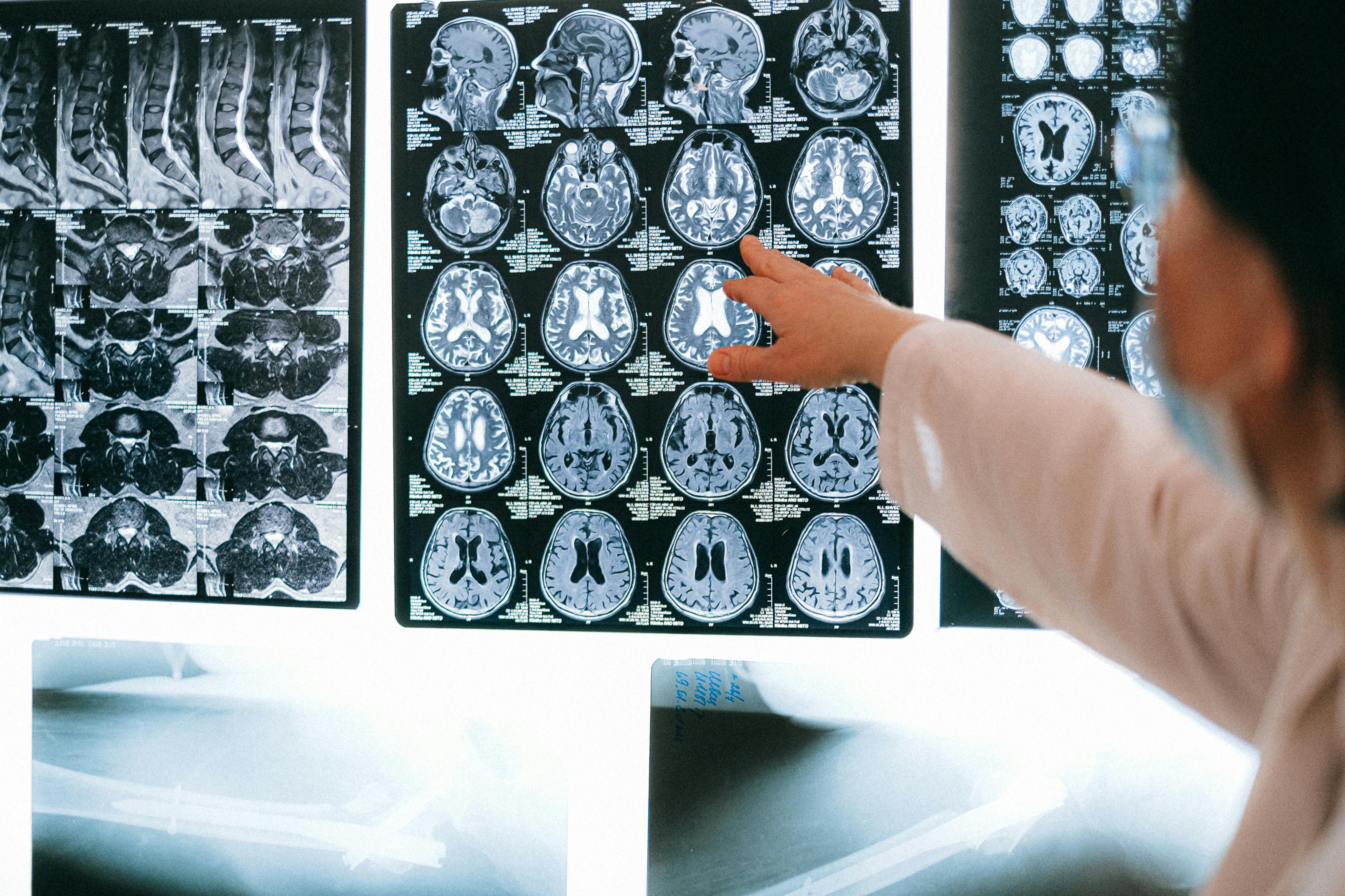 ¿Cómo puede un cerebro hablar dos idiomas? Estos investigadores creen tener una respuesta