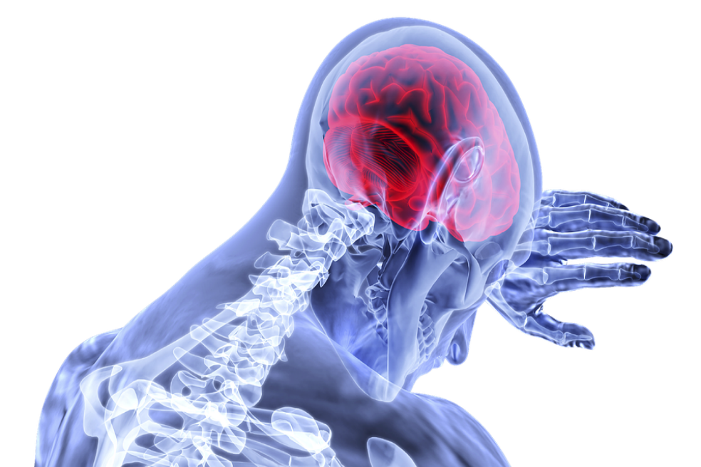 Derrame cerebral es la primera causa de discapacidad de adultos en Colombia