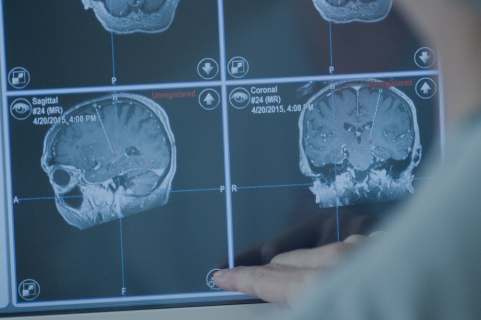 Científicos desarrollan interfaz cerebro-computadora inalámbrica, ¿cómo funciona?