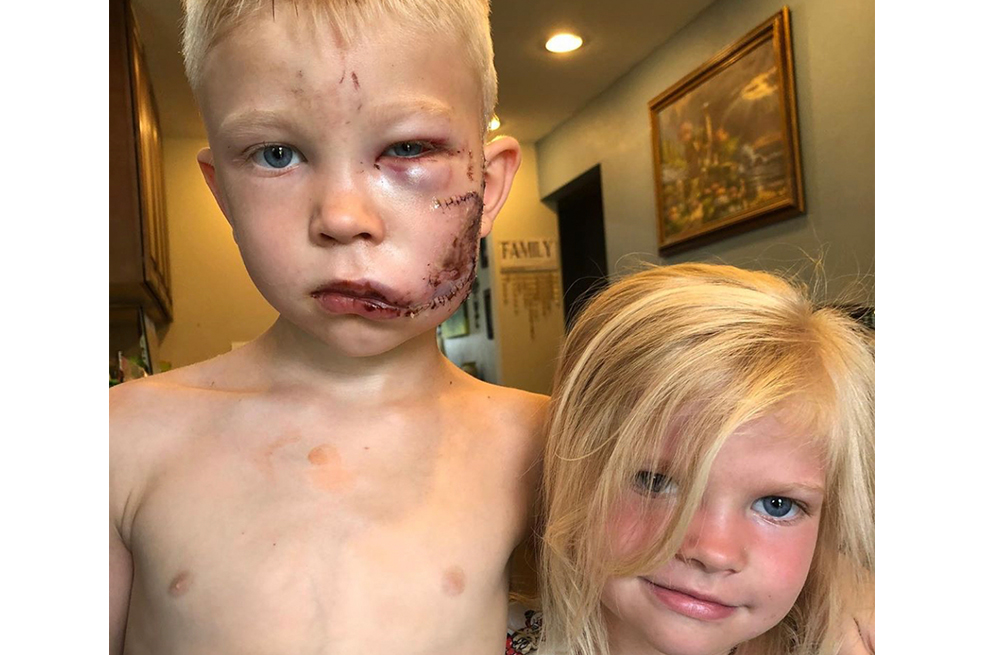 Bridger Walker, el niño de hierro que arriesgó su vida para salvar a su hermana
