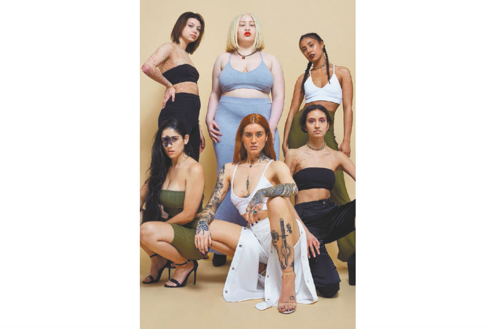 Imperfecciones en la piel, la última campaña en la moda británica