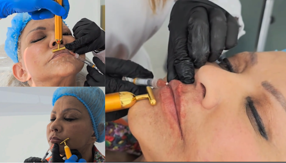 ‘La Gorda Fabiola’ se hizo procedimiento en los labios. Así quedó la humorista