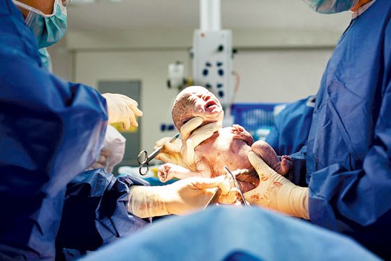 Brasil prohíbe cesáreas antes de las 39 semanas de gestación