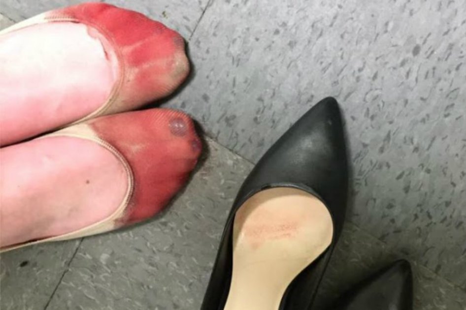 Jefe obligó a mujer a usar tacones hasta sangrar