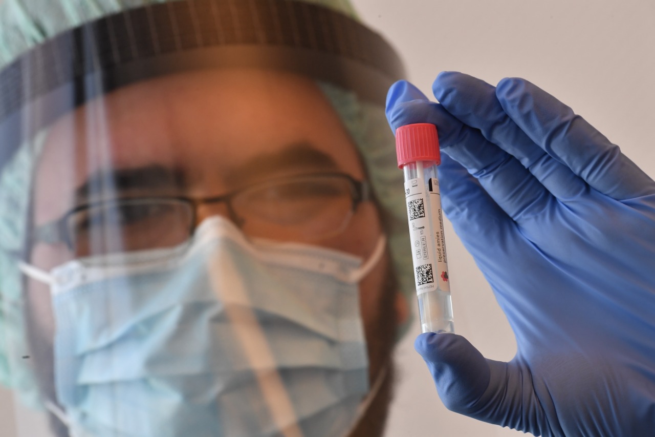 ¿Por qué declaran como covid-19 a fallecidos que no tuvieron síntomas ni prueba positiva?