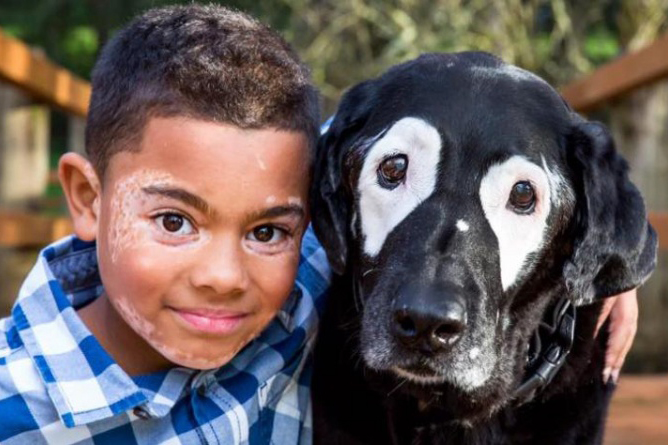 Niño supera depresión después de conocer a un perro con su misma enfermedad