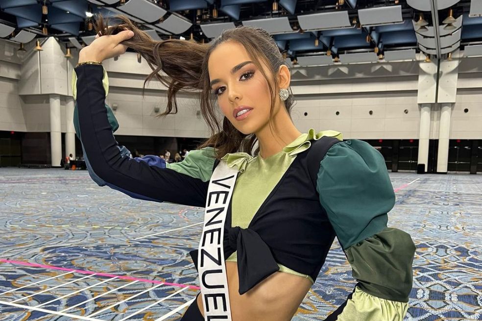 Miss Venezuela revela cómo se veía antes de una cirugía en el rostro