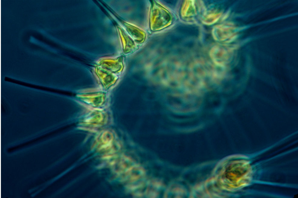 El fitoplancton es la base de la cadena alimenticia oceánica.Wikimedia Commons“El cambio no es bueno, ya que definitivamente afectará el resto de la cadena alimentaria”, dijo la coautora del estudio Stephanie Dutkiewicz, investigadora principal del Departamento de Ciencias Terrestres, Atmosféricas y Planetarias del MIT. “El fitoplancton está en la base, y si la base cambia, pone en peligro todo lo demás a lo largo de la red alimenticia, llegando hasta los osos polares o el atún o casi cualquier cosa que quieras comer o ver en fotos”.