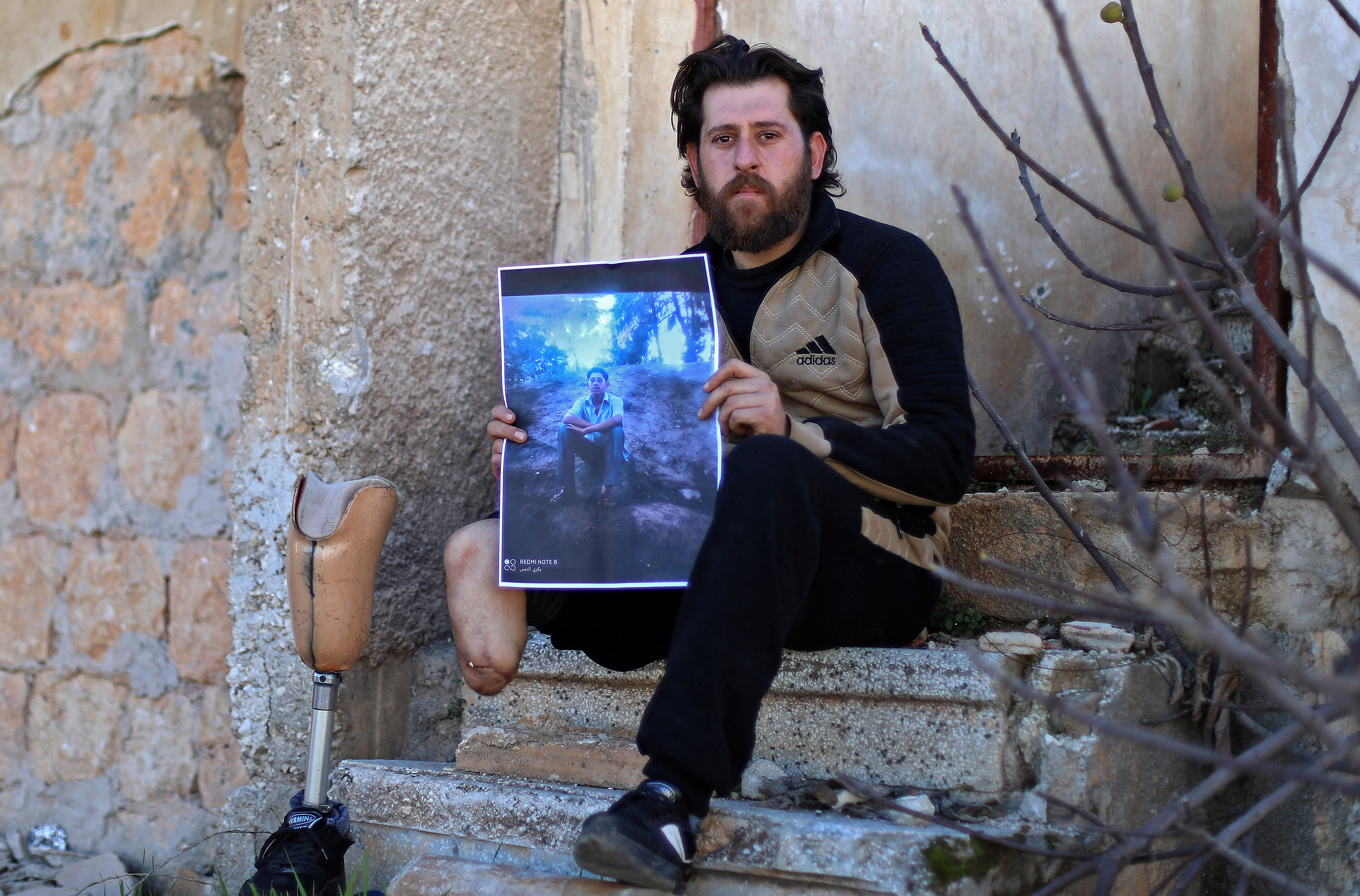 Bakri al-Debs, un médico sirio de 29 años y amputado debajo de la rodilla, posa para una foto en la ciudad de Ihsim, en la provincia de Idlib, noroeste de Siria, controlada por los rebeldes, el 6 de marzo de 2021, mientras sostiene una foto de sí mismo en una pose similar de diez años antes en la Universidad de Tishrin en Latakia, donde estudió Sociología, antes de perder la pierna en un ataque aéreo del gobierno en 2015. Debs dice que cuando estallaron las protestas contra Assad en 2011, fue arrestado varias veces y torturado por fuerzas de seguridad del régimen debido a un caso de confusión de identidad con su primo que comparte el mismo nombre y que encabezó manifestaciones en Ihsim.