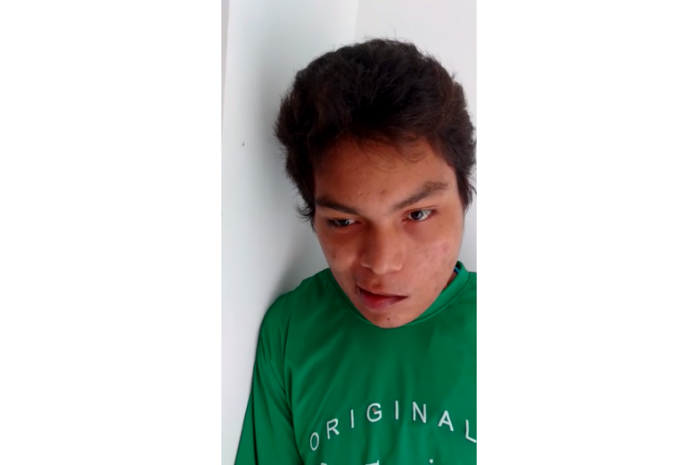 Familia de joven con una bala incrustada en su rostro pide ayuda para que reciba una mejor atención médica