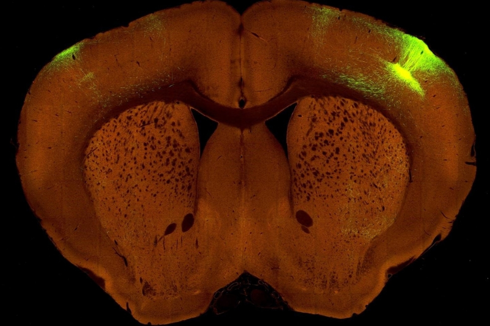 Investigadores presentan un nuevo mapa de alta resolución de cómo está conectado el cerebro