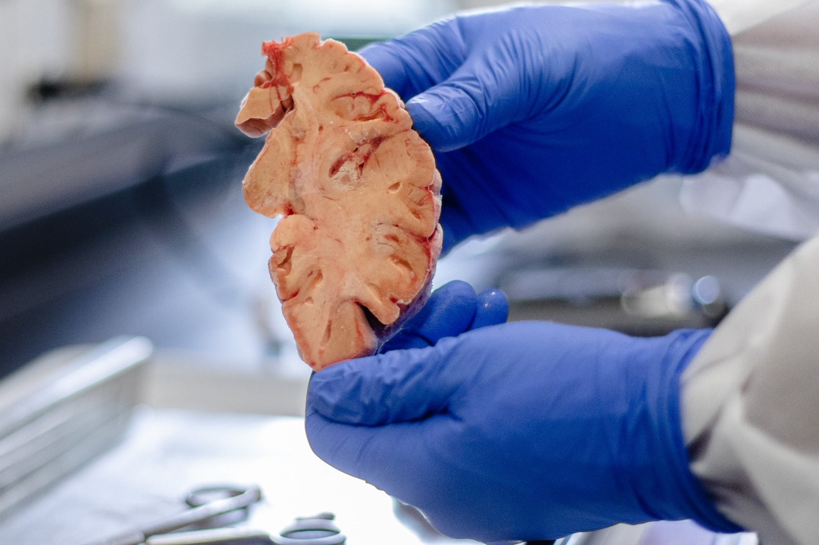 Crearon un sistema de imágenes cerebrales en 3D para mejorar el análisis enfermedades