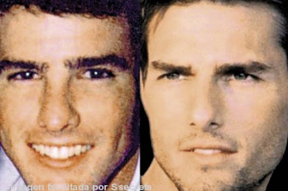 Narices famosas