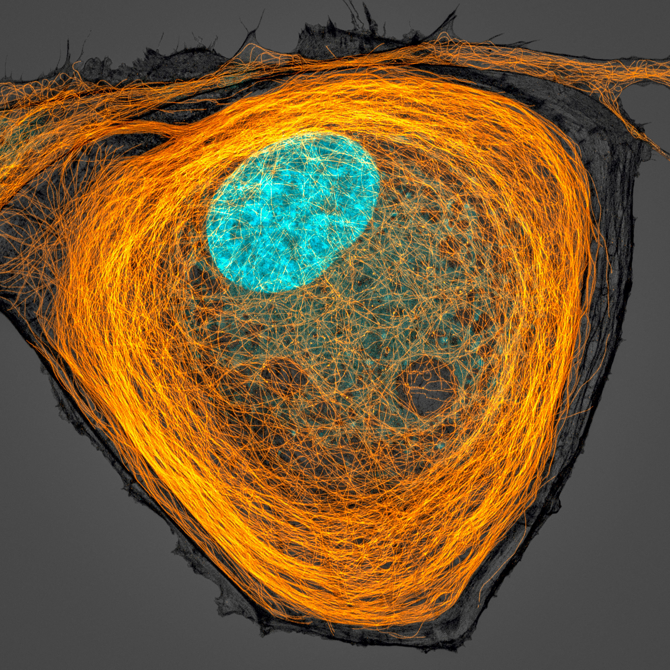 Una fotografía tomada a un 63X de aumento que muestra en detalle una célula, sus microtúbulos (naranja) y su núcleo (azul) se llevó el séptimo lugar en la competencia.