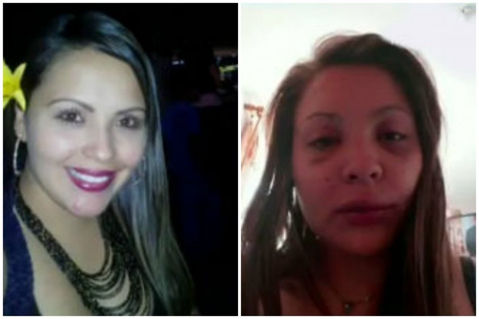 Mujer fue víctima de brutal golpiza en Bogotá en medio de un atraco