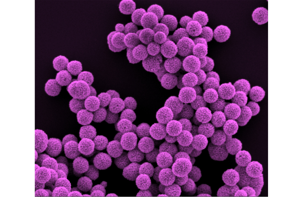 "Imágenes de microscopio electrónico de barrido de nanopartículas de oro mesoporosas", escribió el Instituto.
