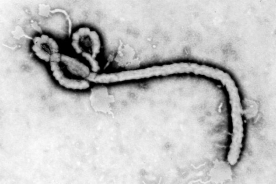Suero experimental para combatir el ébola ya fue probado en estadounidenses contagiados