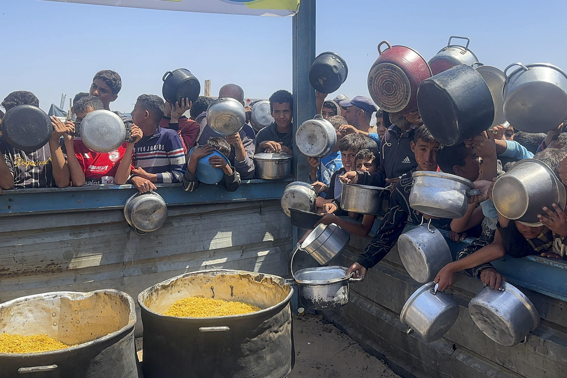 ¿Qué le pasa al cuerpo durante la hambruna? Así se ve el drama humano en Gaza