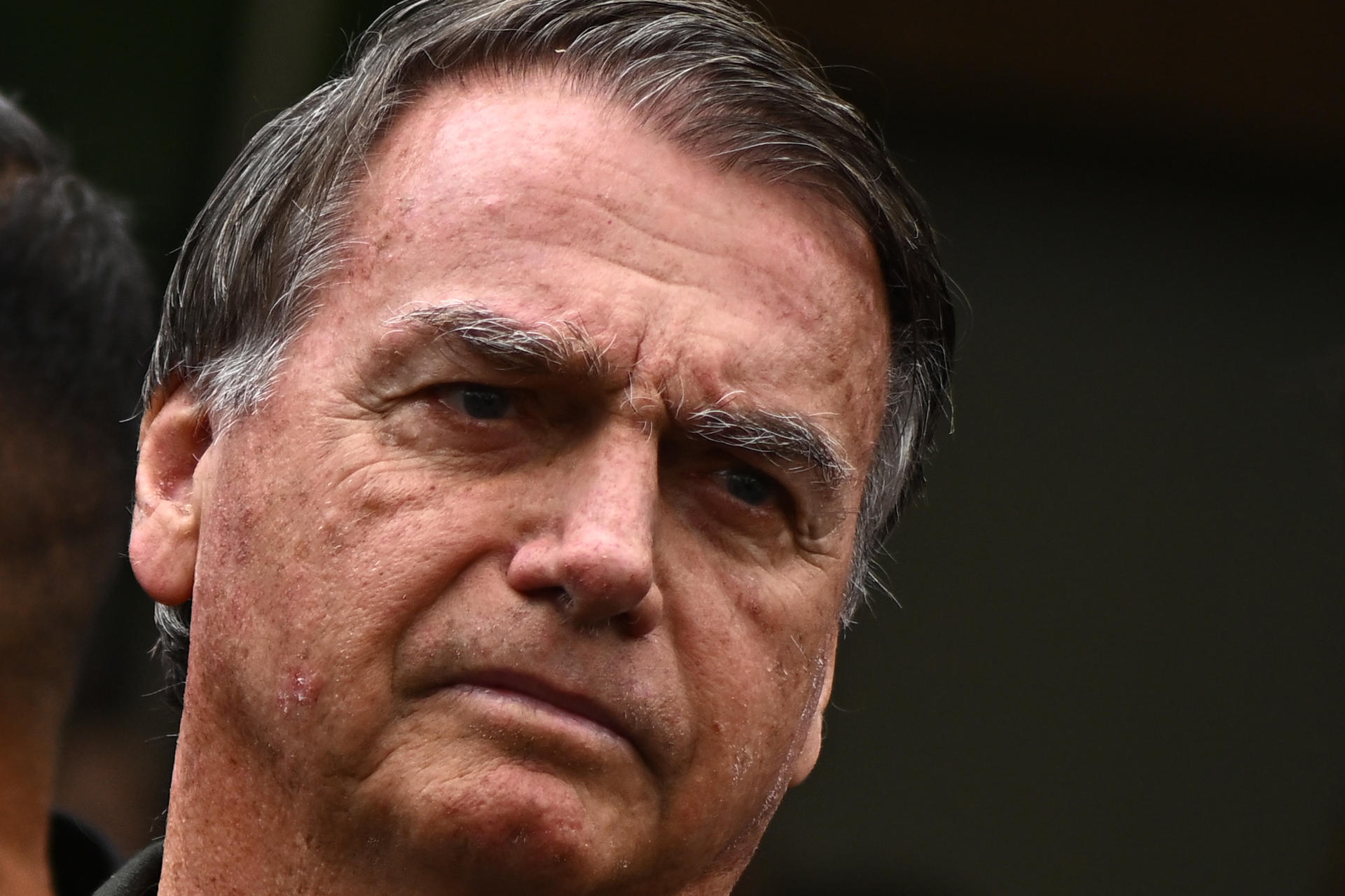 BRA50. BRASILIA (BRASIL), 14/09/2025.- El expresidente de Brasil, Jair Bolsonaro, sale del hospital DF Star tras someterse a un procedimiento médico este domingo, en Brasilia (Brasil). Bolsonaro volvió a recluirse en su residencia en Brasilia siete horas después de haber ingresado en un hospital privado para una intervención quirúrgica, en la que fue su primera salida tras ser condenado a 27 años y tres meses de prisión por golpismo. EFE/Andre Borges