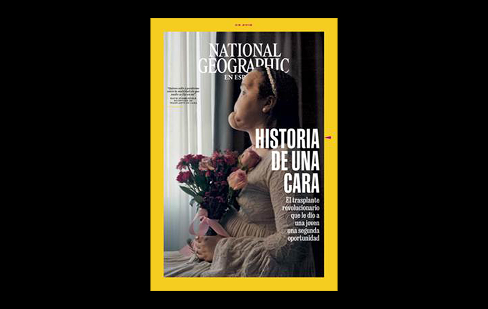 National Geographic revela por primera vez el proceso de un trasplante total de cara