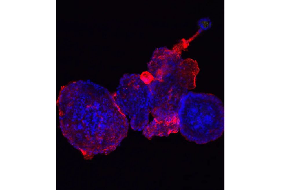 Este bicho es un organoide intestinal y ha sido capturado por microscopía confocal, una práctica que involucra luz láser altamente enfocada.