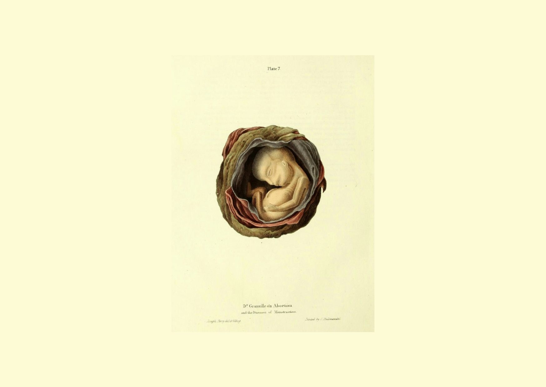 El artista Joseph Perry colaboró con Granville en el libro publicado en 1834 llamado: "Ilustraciones gráficas del aborto, con prolegómenos del desarrollo y metamorfosis del óvulo humano".