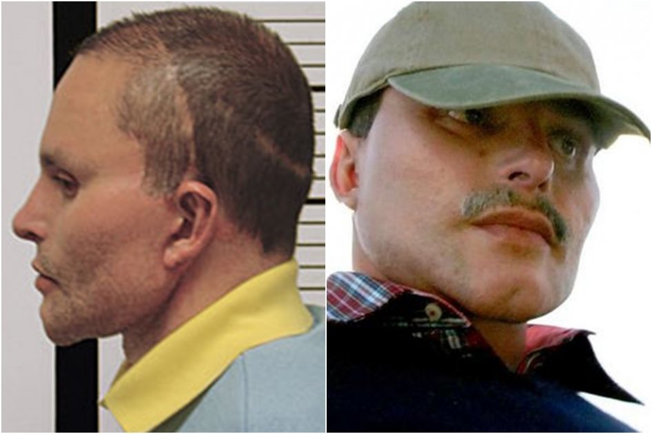 Alias Chupeta se realizó múltiples cirugías plásticas para ocultar su identidad.