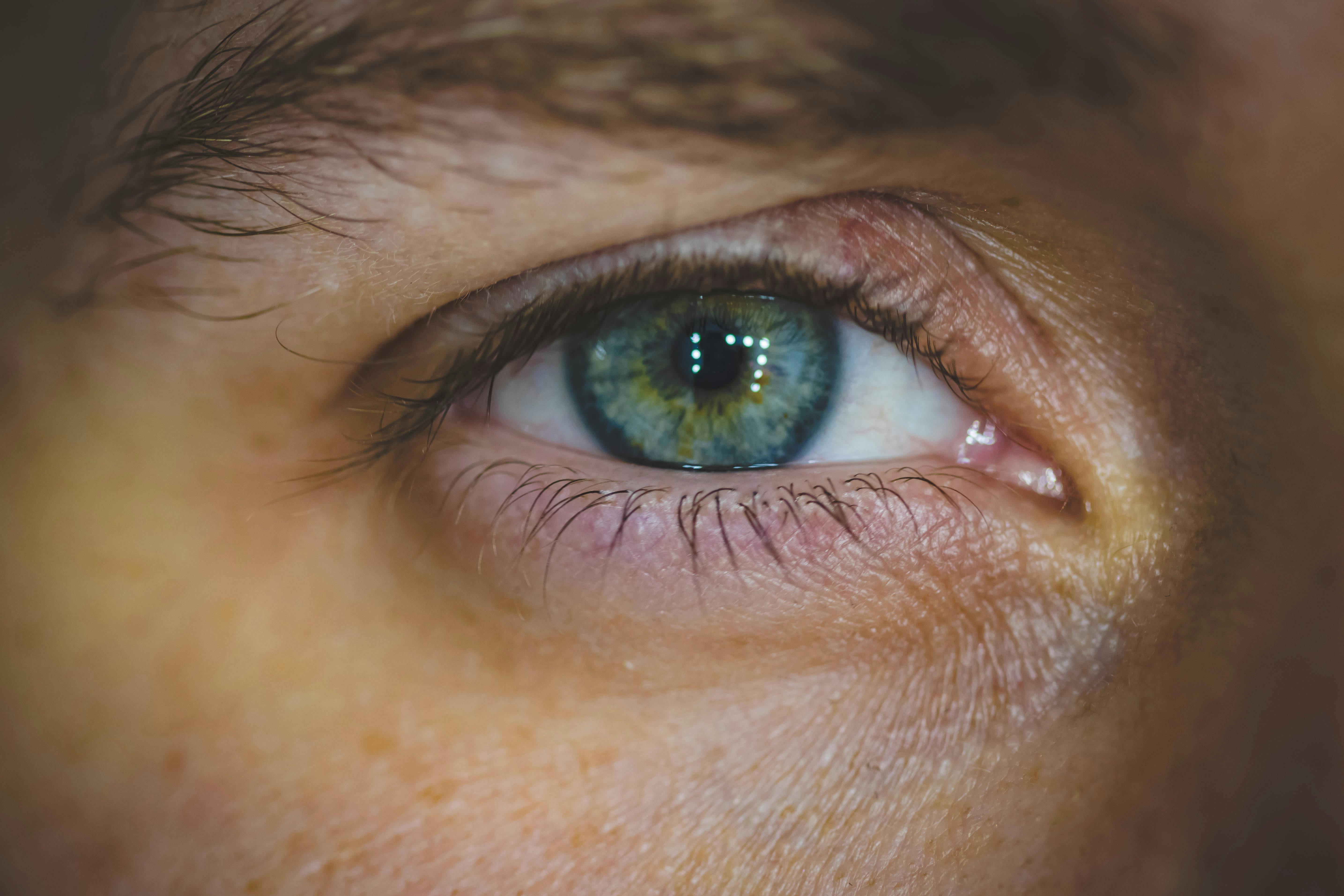 En un estudio, investigadores descubrieron 370,8 casos más de cataratas por cada 100.000 habitantes por cada grado Celsius de aumento de la temperatura media máxima anual.