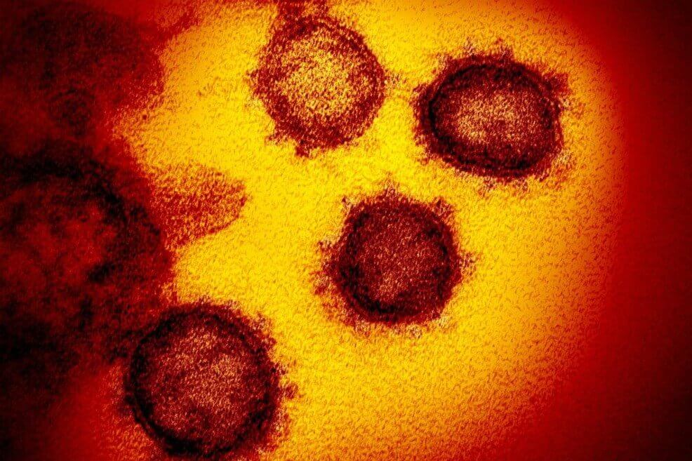 Continúa la controversia por la promoción de la cloroquina contra el coronavirus