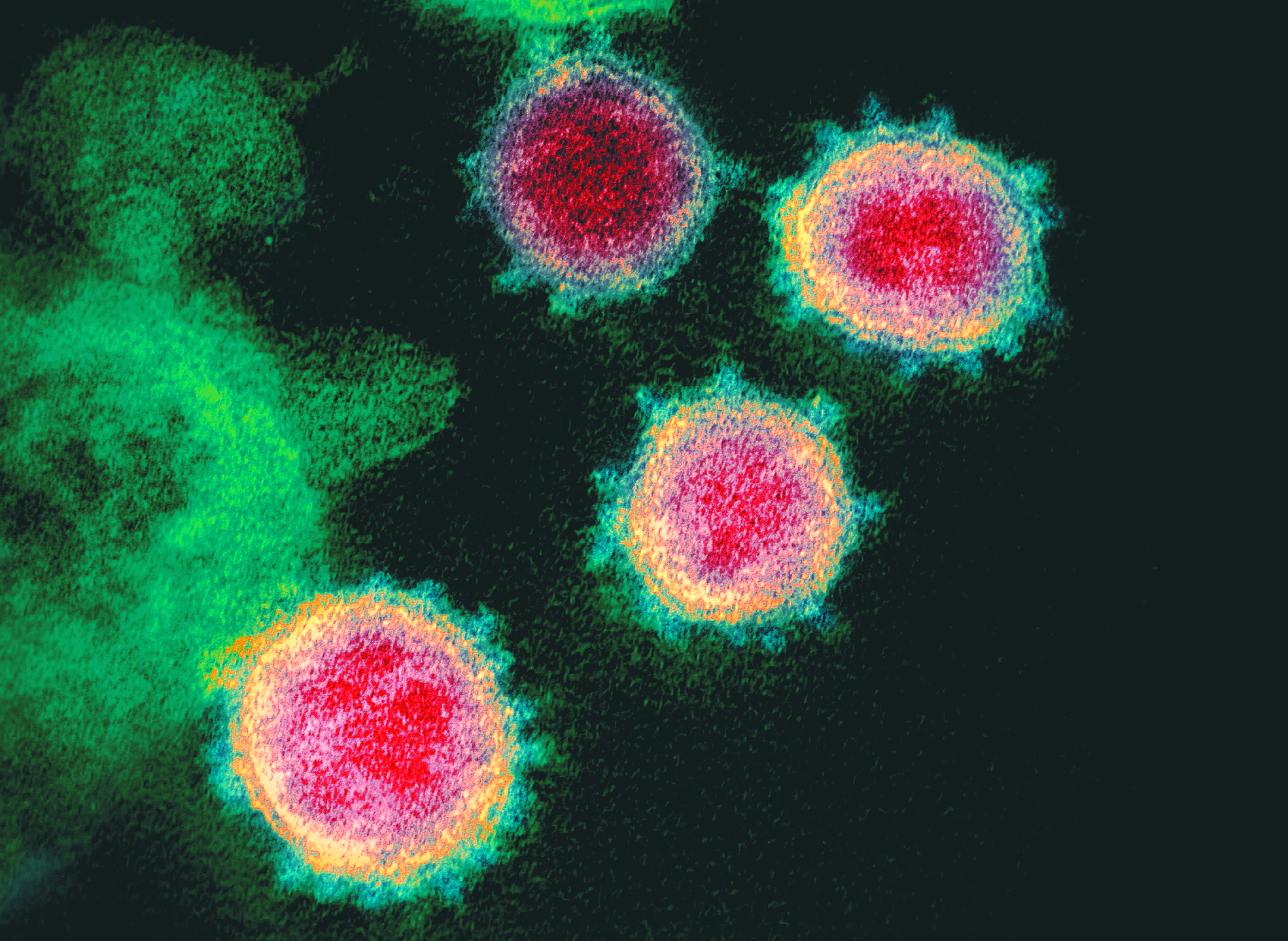En Asamblea Mundial de la Salud piden seguir investigando el origen del Coronavirus