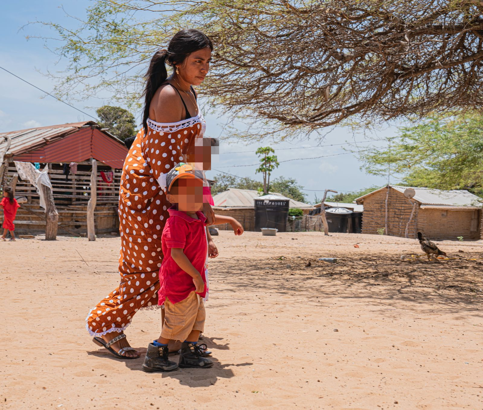 Tras brigada médica del Ejército, niño wayuu con condición genética pudo caminar